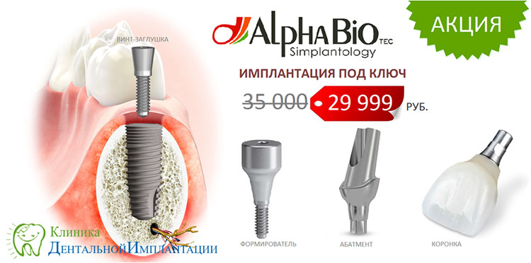 Импланты Alpha Bio (Альфа Био) под ключ на dental-implantology.ru