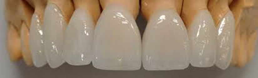 Циркониевые коронки на зубы в Москве dental-implantology.ru